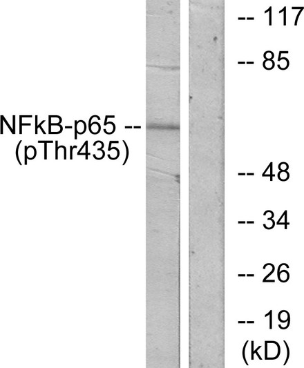 Western blot analysis of lysates from COS7 cells treated with TNF-alpha, using NF-kappaB p65 (Phospho-Thr435) Antibody. The lane on the right is blocked with the phospho peptide.