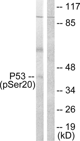 Western blot analysis of lysates from COS7 cells treated with UV 5', using p53 (Phospho-Ser20) Antibody. The lane on the right is blocked with the phospho peptide.