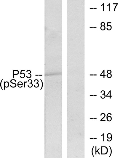 Western blot analysis of lysates from 293 cells treated with UV, using p53 (Phospho-Ser33) Antibody. The lane on the right is blocked with the phospho peptide.