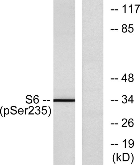 Western blot analysis of lysates from 293 cells treated with 10% serum for 15', using S6 Ribosomal Protein STJ90403