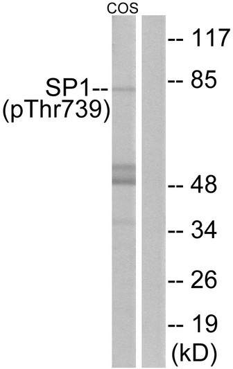 Western blot analysis of lysates from COS7 cells treated with serum 20% 15', using SP1 (Phospho-Thr739) Antibody. The lane on the right is blocked with the phospho peptide.