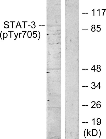 Western blot analysis of lysates from HeLa cells, using STAT3 (Phospho-Tyr705) Antibody. The lane on the right is blocked with the phospho peptide.