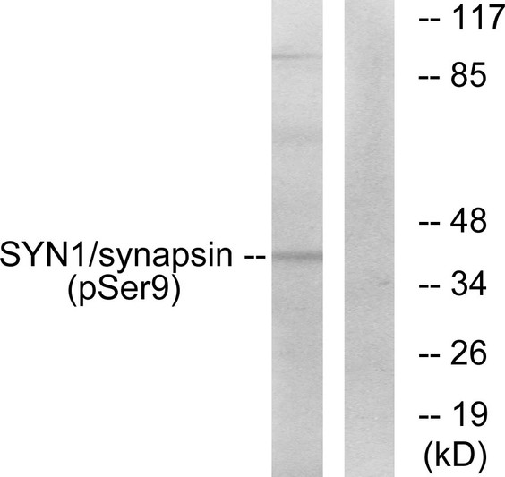 Western blot analysis of lysates from 293 cells treated with PMA 200nM 30', using Synapsin (Phospho-Ser9) Antibody. The lane on the right is blocked with the phospho peptide.