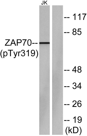 Western blot analysis of lysates from Jurkat cells, using ZAP-70 (Phospho-Tyr319) Antibody. The lane on the right is STJ90436