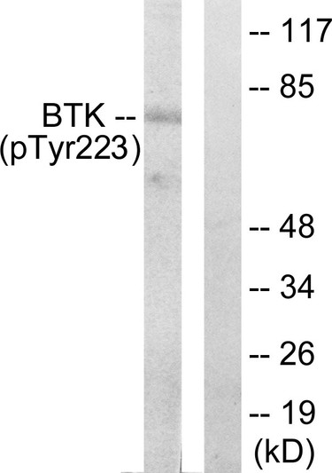 Western blot analysis of lysates from HeLa cells treated with Serum 10% 15', using BTK (Phospho-Tyr223) Antibody. The lane on the right is blocked with the phospho peptide.