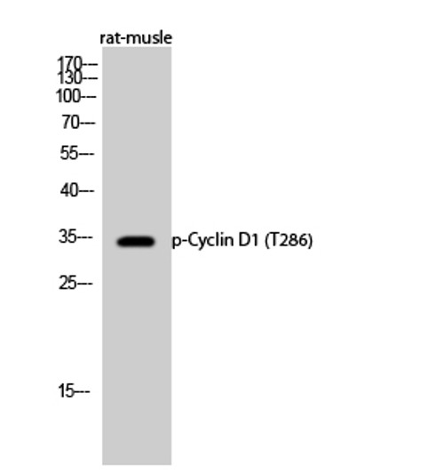Western blot analysis of rat-musle cells using Phospho-Cyclin D1 (T286) Polyclonal Antibody diluted at 1：500