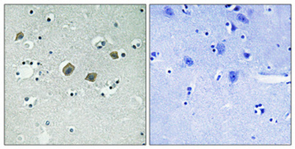 Immunohistochemical analysis of paraffin-embedded Human brain. Antibody was diluted at 1:100 (4°C overnight). High-pressure and temperature Tris-EDTA, pH8.0 was used for antigen retrieval. Negetive contrl (right) obtaned from antibody was pre-absorbed by immunogen peptide.