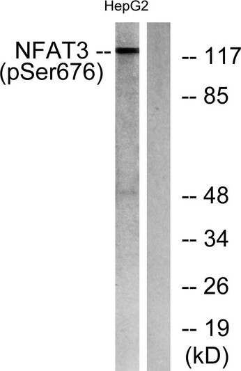 Western blot analysis of lysates from HepG2 cells treated with Ca2+ 40 μM 30', using NFAT3 (Phospho-Ser676) Antibody. STJ90473