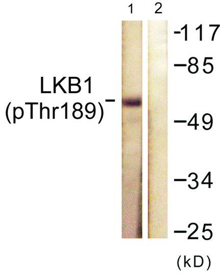Western blot analysis of lysates from NIH/3T3 cells treated with PMA 125ng/ml 30', using LKB1 (Phospho-Thr189) Antibody. The lane on the right is blocked with the phospho peptide.