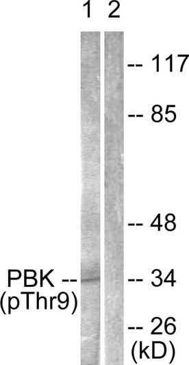 Western blot analysis of lysates from K562 cells treated with UV 30', using PBK/TOPK (Phospho-Thr9) Antibody. The lane on the right is blocked with the phospho peptide.