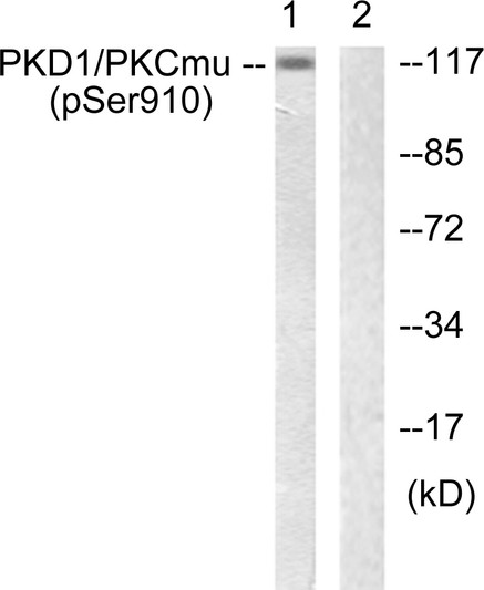 Western blot analysis of lysates from A431 cells, using PKD1/PKC mu (Phospho-Ser910) Antibody. The lane on the right is blocked with the phospho peptide.