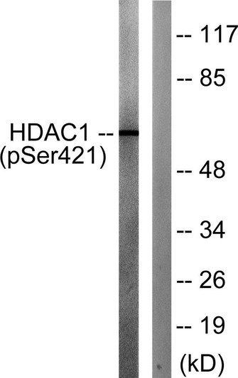 Western blot analysis of lysates from Jurkat cells treated with EGF 200 ng/ml for 30', using HDAC1 (Phospho-Ser421) STJ90497