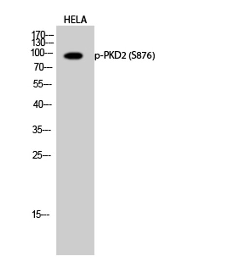 Western blot analysis of HELA cells using Phospho-PKD2 (S876) Polyclonal Antibody diluted at 1：1000