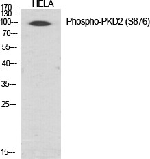 Western blot analysis of various cells using Phospho-PKD2 (S876) Polyclonal Antibody diluted at 1:1000 STJ90501