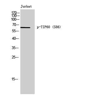 Western blot analysis of Jurkat cells using Phospho-TIP60 (S86) Polyclonal Antibody STJ90502
