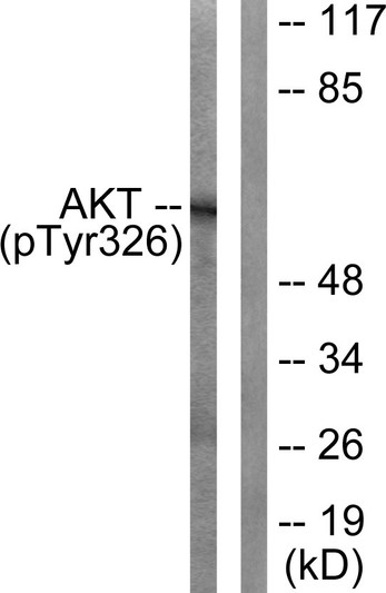 Western blot analysis of lysates from mouse liver, using Akt (Phospho-Tyr326) Antibody. The lane on the right is blocked with the phospho peptide.