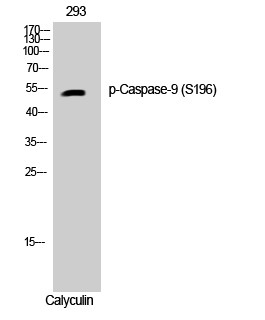 Western blot analysis of 293 cells using Phospho-Caspase-9 (S196) Polyclonal Antibody diluted at 1:1000 STJ90505