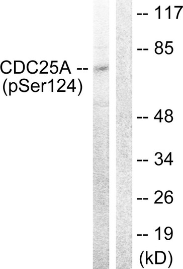 Western blot analysis of lysates from 293 cells treated with UV 15', using CDC25A (Phospho-Ser124) Antibody. The lane on the right is blocked with the phospho peptide.