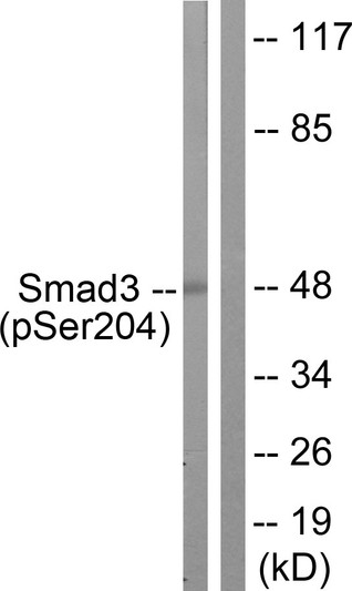 Western blot analysis of lysates from NIH/3T3 cells treated with Serum 20% 15', using Smad3 (Phospho-Ser204) Antibody. The lane on the right is blocked with the phospho peptide.