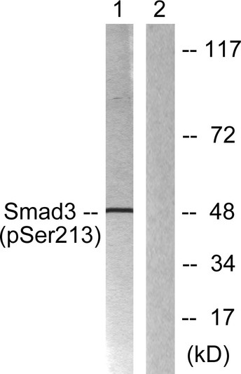 Western blot analysis of lysates from HT29 cells, using Smad3 (Phospho-Ser213) Antibody. The lane on the right was STJ90524