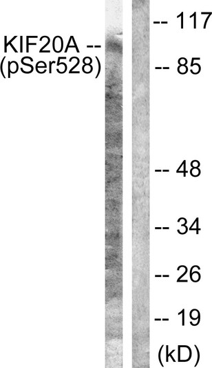 Western blot analysis of lysates from 293 cells, using KIF20A (Phospho-Ser528) Antibody. The lane on the right is blocked with the phospho peptide.