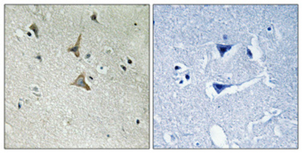 Immunohistochemical analysis of paraffin-embedded Human brain. Antibody was diluted at 1:100 (4°C overnight). High-pressure and temperature Tris-EDTA, pH8.0 was used for antigen retrieval. Negetive contrl (right) obtaned from antibody was pre-absorbed by immunogen peptide.