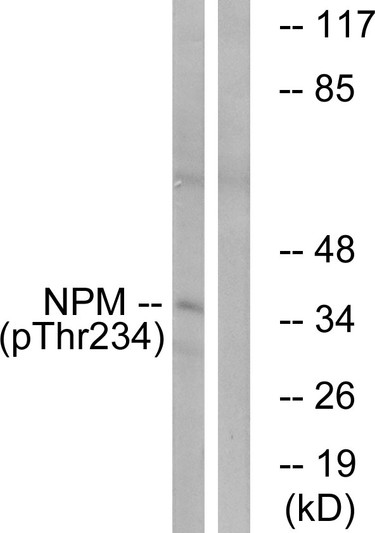 Western blot analysis of lysates from HeLa cells treated with nocodazole 1ug/ml 18h, using NPM (Phospho-Thr234) Antibody. The lane on the right is blocked with the phospho peptide.