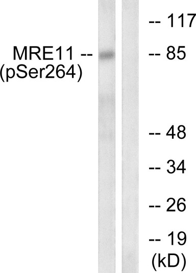 Western blot analysis of lysates from NIH/3T3 cells treated with forskolin 40nM 30', using MRE11 (Phospho-Ser264) Antibody. The lane on the right is blocked with the phospho peptide.