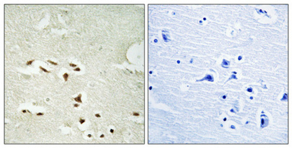 Immunohistochemical analysis of paraffin-embedded Human brain. Antibody was diluted at 1:100 (4°C overnight). High-pressure and temperature Tris-EDTA, pH8.0 was used for antigen retrieval. Negetive contrl (right) obtaned from antibody was pre-absorbed by immunogen peptide.