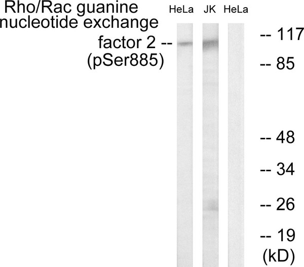 Western blot analysis of lysates from HeLa cells treated with TSA 400nM 24H and Jurkat cells treated with forskolin 40nM 30', using Rho/Rac Guanine Nucleotide Exchange Factor 2 (Phospho-Ser885) Antibody. The lane on the right is blocked with the phospho peptide.