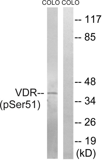 Western blot analysis of lysates from COLO205 cells treated with Insulin 0.01U/ml 15', using Vitamin D3 Receptor (Phospho-Ser51) Antibody. The lane on the right is blocked with the phospho peptide.
