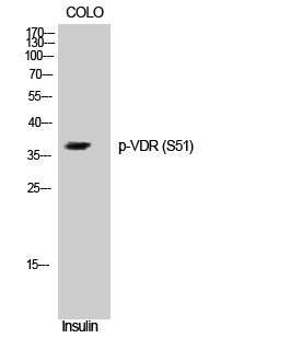 Western blot analysis of COLO cells using Phospho-VDR (S51) Polyclonal Antibody on cells' nuclei extracted by Minute™ STJ90600