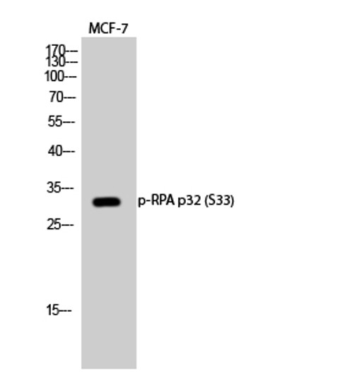 Western blot analysis of MCF-7 cells using Phospho-RPA p32 (S33) Polyclonal Antibody diluted at 1：500 cells nucleus extracted by Minute TM Cytoplasmic and Nuclear Fractionation kit (SC-003, Inventbiotech, MN, USA).