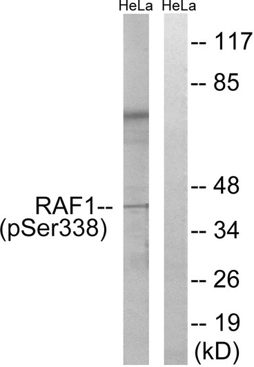 Western blot analysis of lysates from HeLa cells treated with paclitaxel 1uM 24h, using C-RAF (Phospho-Ser338) Antibody. The lane on the right is blocked with the phospho peptide.