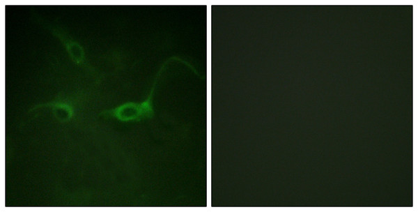 Immunofluorescence analysis of COS7 cells, using FGFR1 (Phospho-Tyr654) Antibody. The picture on the right is blocked with the phospho peptide.