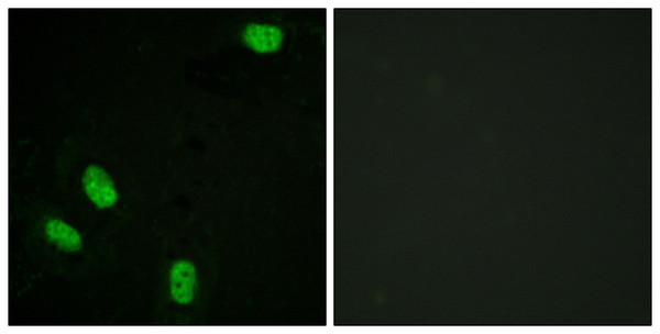 Immunofluorescence analysis of HeLa cells, using Progesterone Receptor (Phospho-Ser294) Antibody. The picture on the right is blocked with the phospho peptide.