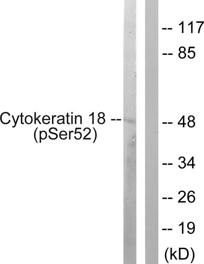 Western blot analysis of lysates from HepG2 cells, using Keratin 18 (Phospho-Ser52) Antibody. The lane on the right is blocked with the phospho peptide.