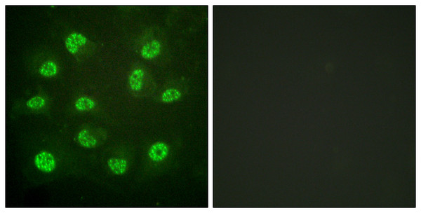 Immunofluorescence analysis of HUVEC cells, using Estrogen Receptor-beta (Phospho-Ser105) Antibody. The picture on the right is blocked with the phospho peptide.