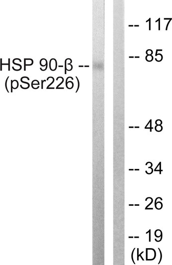 Western blot analysis of lysates from A549 cells treated with serum 20% 15', using HSP90B (Phospho-Ser226) Antibody. The lane on the right is blocked with the phospho peptide.
