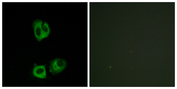 Immunofluorescence analysis of HeLa cells, using Lck (Phospho-Tyr393) Antibody. The picture on the right is blocked with the phospho peptide.