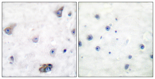 Immunohistochemistry analysis of paraffin-embedded human brain, using GABA-RB (Phospho-Ser434) Antibody. The picture on the right is blocked with the phospho peptide. Immunohistochemistry analysis of paraffin-embedded human brain, using GABA-RB (Phospho-Ser434) Antibody. The picture on the right is blocked with the phospho peptide.