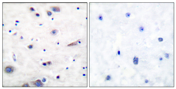 Immunohistochemistry analysis of paraffin-embedded human brain, using SHP-2 (Phospho-Tyr580) Antibody. The picture on the right is blocked with the phospho peptide.