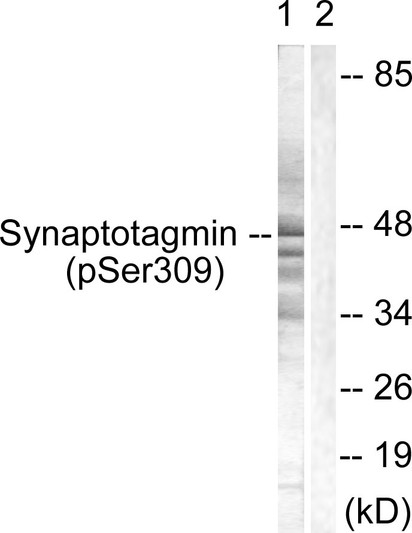 Western blot analysis of lysates from 293 cells treated with Sobital 0.4M 30', using Synaptotagmin (Phospho-Ser309) Antibody. The lane on the right is blocked with the phospho peptide. Western blot analysis of lysates from 293 cells treated with Sobital 0.4M 30', using Synaptotagmin (Phospho-Ser309) Antibody. The lane on the right is blocked with the phospho peptide.