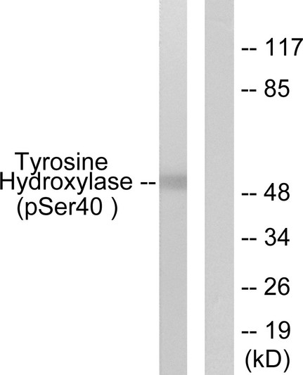 Western blot analysis of lysates from RAW264.7 cells treated with UV 30', using Tyrosine Hydroxylase (Phospho-Ser40) Antibody. The lane on the right is blocked with the phospho peptide.