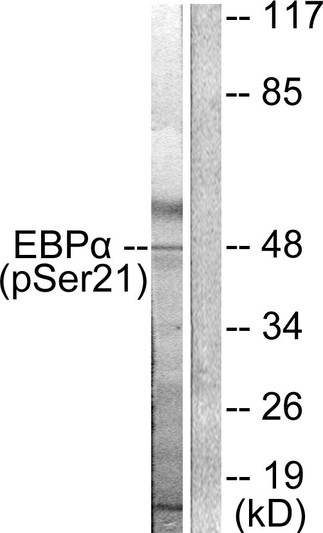Western blot analysis of lysates from HepG2 cells treated with EGF 200ng/ml 5', using C/EBP-alpha (Phospho-Ser21) Antibody. The lane on the right is blocked with the phospho peptide.