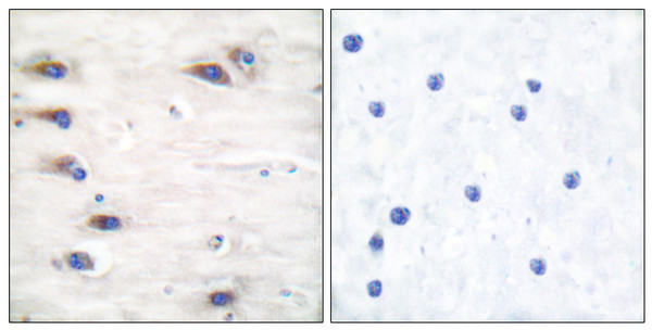 Immunohistochemistry analysis of paraffin-embedded human brain, using KSR (Phospho-Ser392) Antibody. The picture on the right is blocked with the phospho peptide.