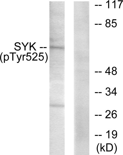Western blot analysis of lysates from A549 cells, using SYK (Phospho-Tyr525) Antibody. The lane on the right is blocked with the phospho peptide.