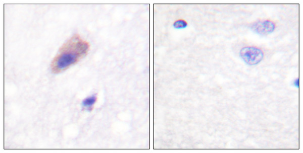 Immunohistochemistry analysis of paraffin-embedded human brain, using Dynamin-1 (Phospho-Ser774) Antibody. The picture on the right is blocked with the phospho peptide.