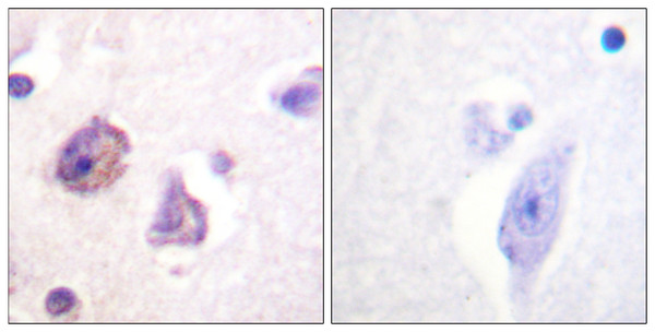 Immunohistochemistry analysis of paraffin-embedded human brain, using FAK (Phospho-Tyr576) Antibody. The picture on the right is blocked with the phospho peptide.