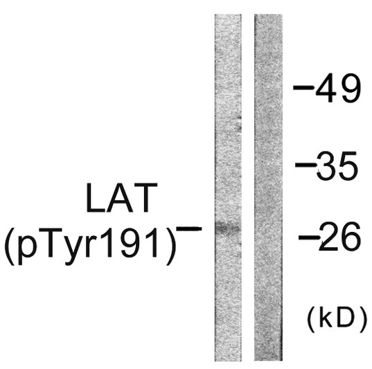 Western blot analysis of lysates from NIH/3T3 cells, using LAT (Phospho-Tyr191) Antibody. The lane on the right is blocked with the phospho peptide.